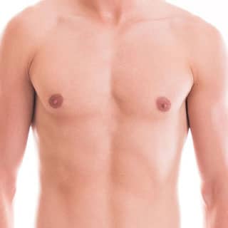 augmentation mammaire en Tunisie