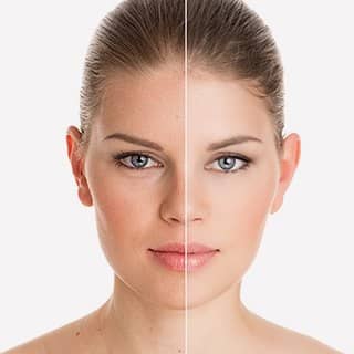 chirurgie pour raccourcir la pointe du menton tunisie